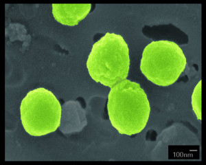 Cyanobacteria, otherwise known as single celled blue-green algae